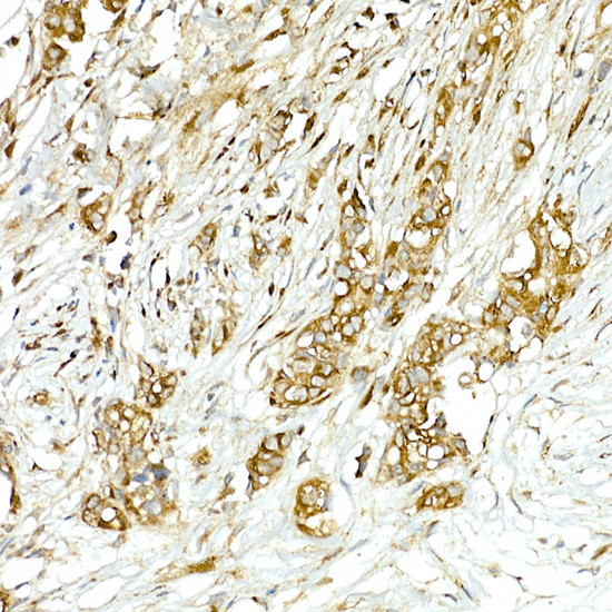 COPB2 Antibody in Immunohistochemistry (Paraffin) (IHC (P))