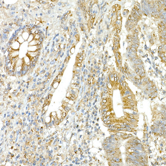 COPB2 Antibody in Immunohistochemistry (Paraffin) (IHC (P))