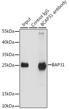 BAP31 Antibody in Immunoprecipitation (IP)