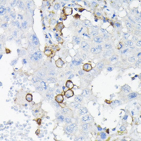 CD85k (Gp49b) Antibody in Immunohistochemistry (Paraffin) (IHC (P))