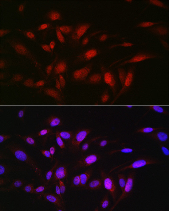 OGFR Antibody in Immunocytochemistry (ICC/IF)