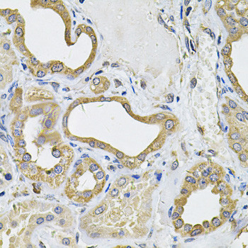 CD275 (B7-H2) Antibody in Immunohistochemistry (Paraffin) (IHC (P))