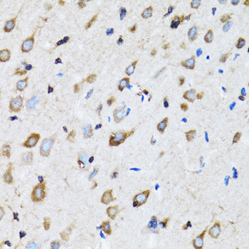 NDE1 Antibody in Immunohistochemistry (Paraffin) (IHC (P))