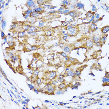 NDE1 Antibody in Immunohistochemistry (Paraffin) (IHC (P))