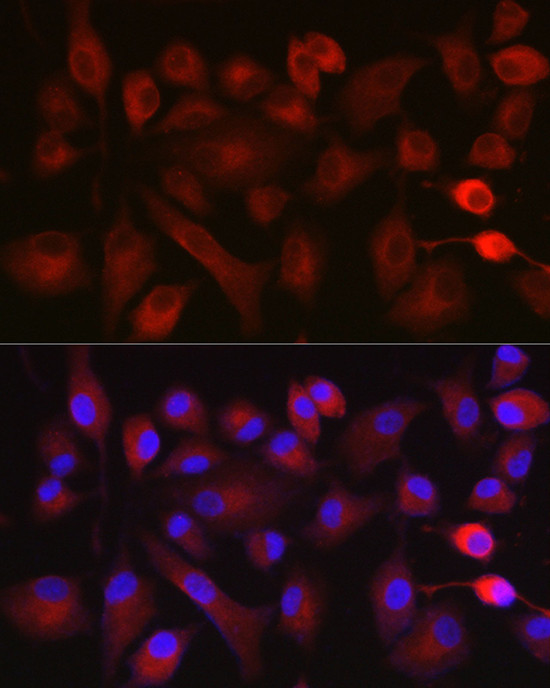 NOX5 Antibody in Immunocytochemistry (ICC/IF)