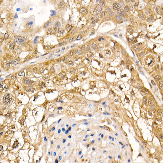 STS1 Antibody in Immunohistochemistry (Paraffin) (IHC (P))