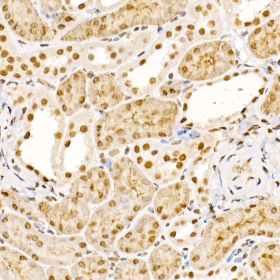 STS1 Antibody in Immunohistochemistry (Paraffin) (IHC (P))