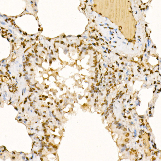 STS1 Antibody in Immunohistochemistry (Paraffin) (IHC (P))