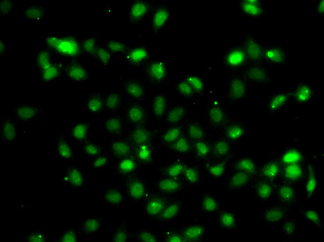 BCL6 Antibody in Immunocytochemistry (ICC/IF)