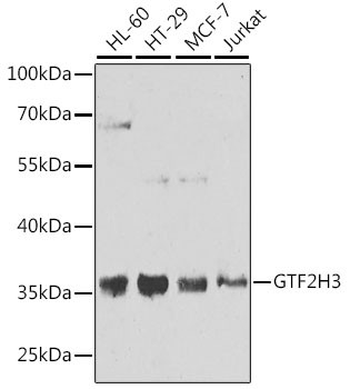 GTF2H3 Antibody in Western Blot (WB)