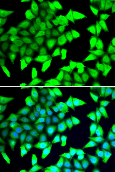 HDAC5 Antibody in Immunocytochemistry (ICC/IF)