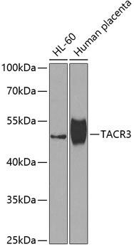 TACR3 Antibody in Western Blot (WB)