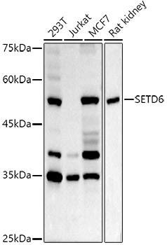 SETD6 Antibody in Western Blot (WB)