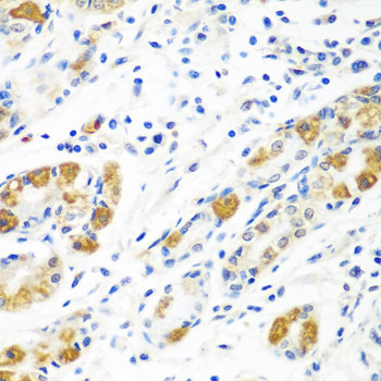 Flavin reductase Antibody in Immunohistochemistry (Paraffin) (IHC (P))