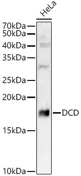 DCD Antibody in Western Blot (WB)
