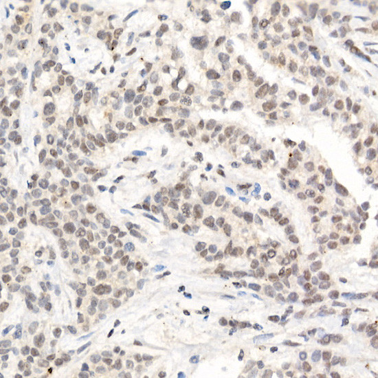 L3MBTL3 Antibody in Immunohistochemistry (Paraffin) (IHC (P))