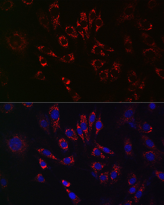 TFEB Antibody in Immunocytochemistry (ICC/IF)