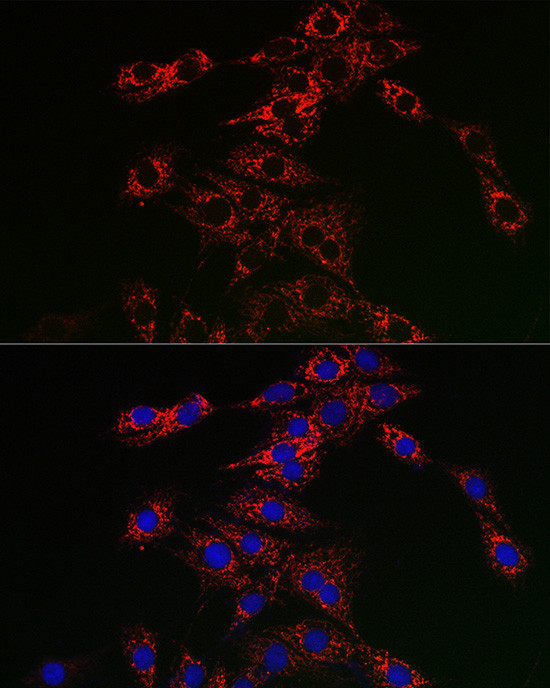 TFEB Antibody in Immunocytochemistry (ICC/IF)