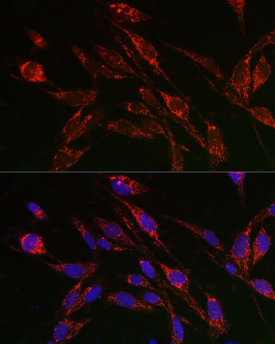 TFEB Antibody in Immunocytochemistry (ICC/IF)