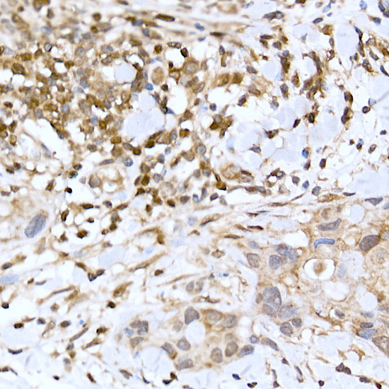 TFEB Antibody in Immunohistochemistry (Paraffin) (IHC (P))