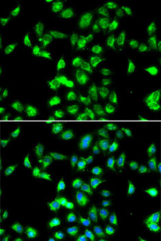 Kallistatin Antibody in Immunocytochemistry (ICC/IF)