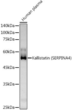 Kallistatin Antibody in Western Blot (WB)