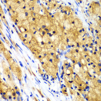 CAPG Antibody in Immunohistochemistry (Paraffin) (IHC (P))