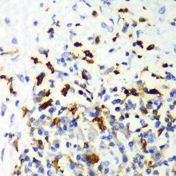 CAPG Antibody in Immunohistochemistry (Paraffin) (IHC (P))