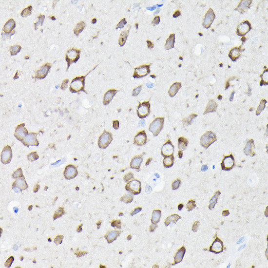 EEF1A2 Antibody in Immunohistochemistry (Paraffin) (IHC (P))