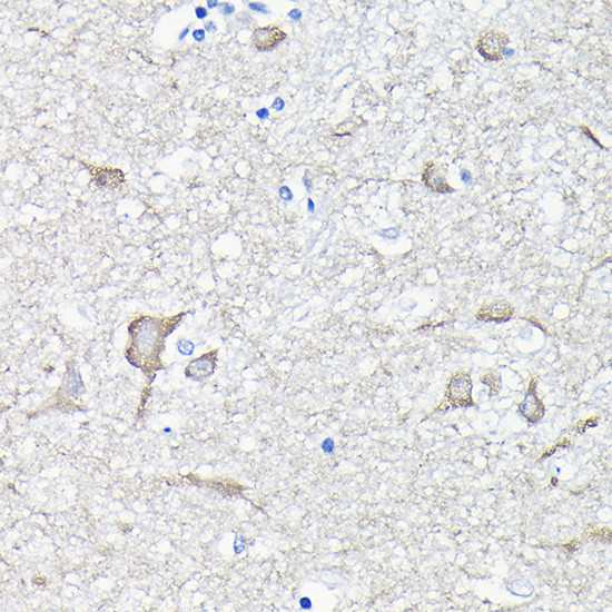 EEF1A2 Antibody in Immunohistochemistry (Paraffin) (IHC (P))