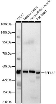 EEF1A2 Antibody in Western Blot (WB)