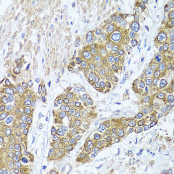 PEX14 Antibody in Immunohistochemistry (Paraffin) (IHC (P))