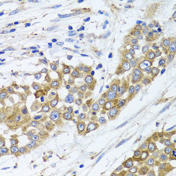 PEX14 Antibody in Immunohistochemistry (Paraffin) (IHC (P))