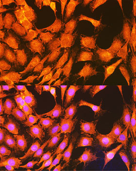 PHKG2 Antibody in Immunocytochemistry (ICC/IF)