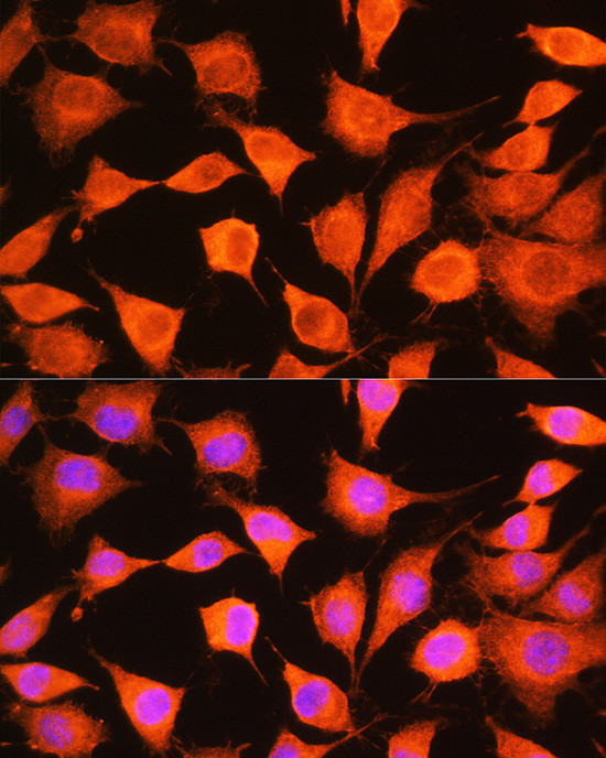 PHKG2 Antibody in Immunocytochemistry (ICC/IF)