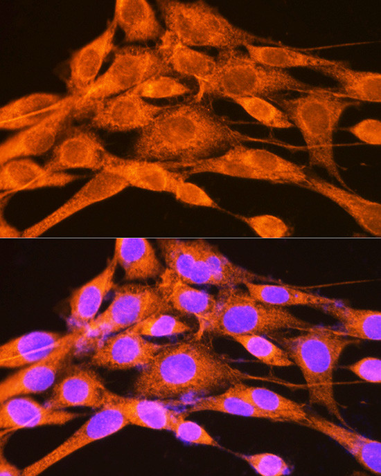 PHKG2 Antibody in Immunocytochemistry (ICC/IF)