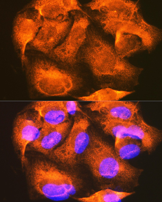 PHKG2 Antibody in Immunocytochemistry (ICC/IF)