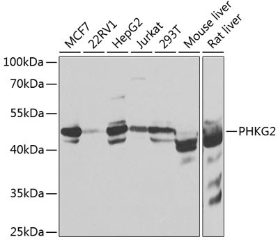 PHKG2 Antibody in Western Blot (WB)