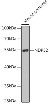 CALCOCO2 Antibody in Western Blot (WB)