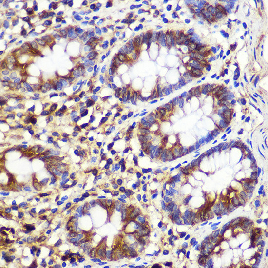 ATG10 Antibody in Immunohistochemistry (Paraffin) (IHC (P))