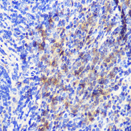 ATG10 Antibody in Immunohistochemistry (Paraffin) (IHC (P))