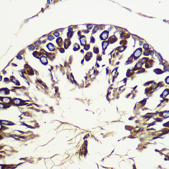 ATG10 Antibody in Immunohistochemistry (Paraffin) (IHC (P))