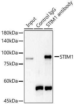 STIM1 Antibody in Immunoprecipitation (IP)