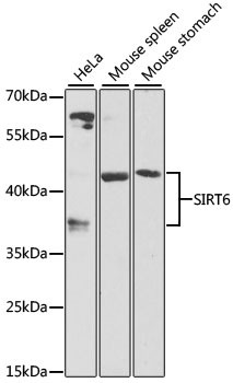 SIRT6 Antibody in Western Blot (WB)