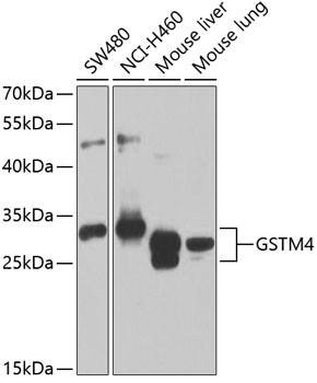 GSTM4 Antibody in Western Blot (WB)