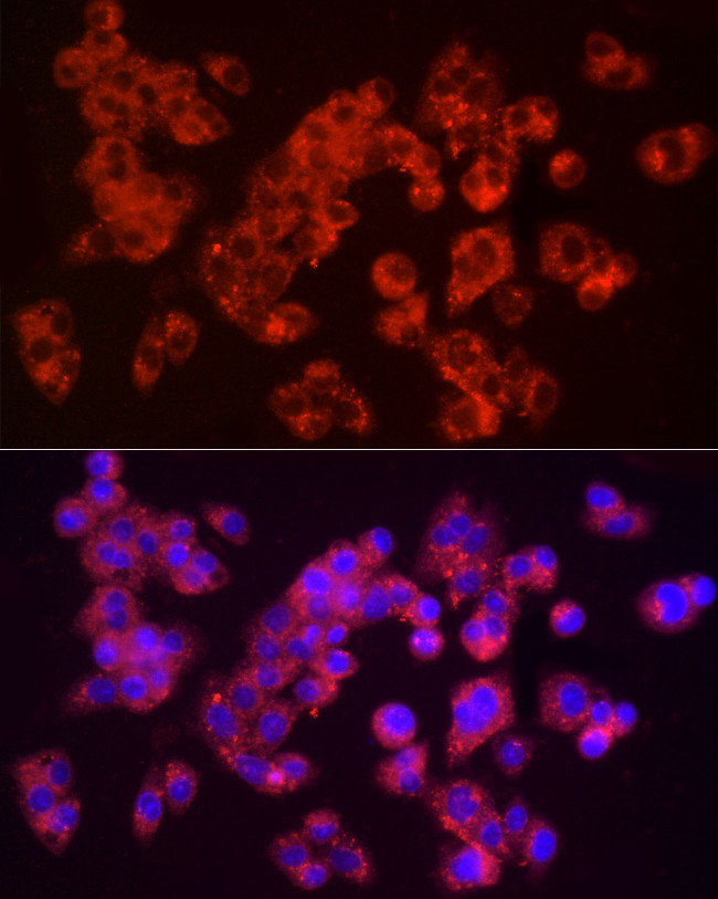 Furin Antibody in Immunocytochemistry (ICC/IF)