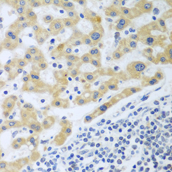 SHBG Antibody in Immunohistochemistry (Paraffin) (IHC (P))