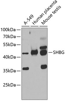 SHBG Antibody in Western Blot (WB)