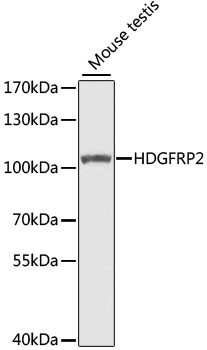 HDGFRP2 Antibody in Western Blot (WB)