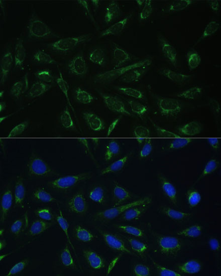 HCCS Antibody in Immunocytochemistry (ICC/IF)